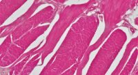 Photo muscle fiber types